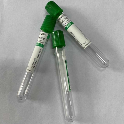 Routine-Clinicalbiochemistry-Test-Blut, das Rohr-Grün-Spitze sammelt