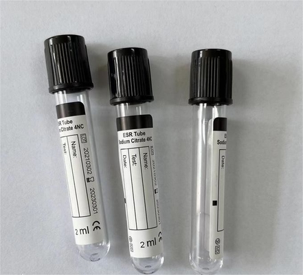 Blut-Sammlung ESR-Rohr CER ISO13485 3,8% Natriumcitrat HAUSTIER Glas