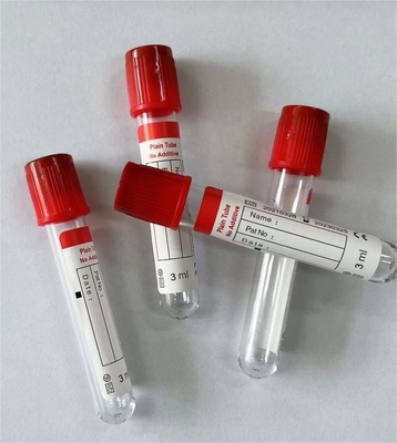 Die glatte Innenwand des Schlauchs verhindert die Anhaftung von Blutzellen in einem einfachen Vakuumschlauch 1 ml-10 ml