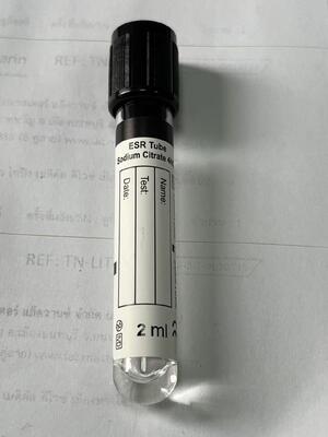 1.6 ml ESR Vakuumröhre mit 3,8% Natriumzitrat zur Sedimentationsrate