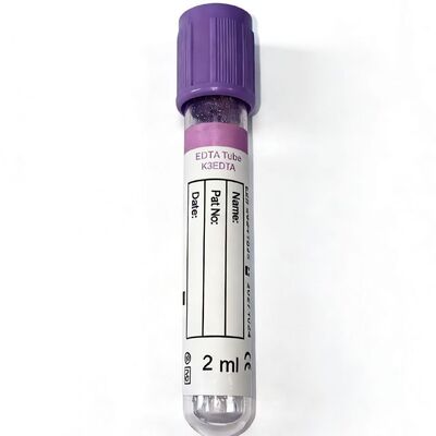 Vollblut-EDTA-Röhrchen: Wesentlich für Hämatologie und molekulare Testintegrität